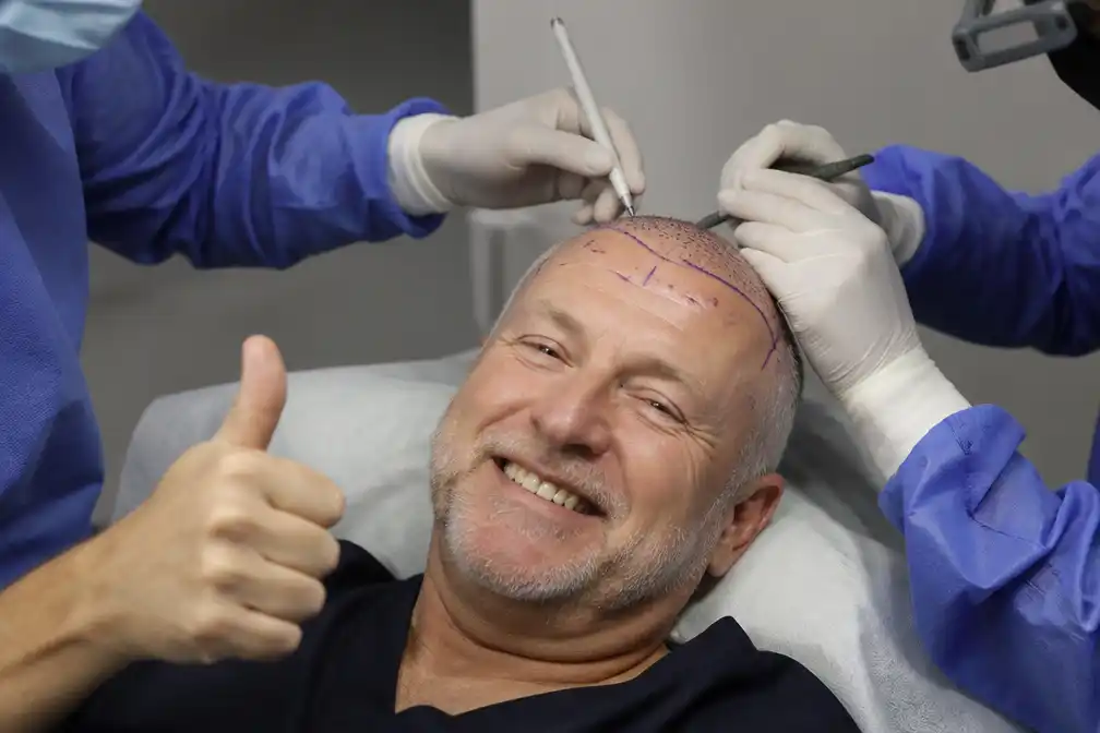 Gordon ondergaat opnieuw haartransplantatie, dit keer in Delft